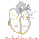 BIOS Diagnostics Premium Blood Pressure Monitor with AFIB